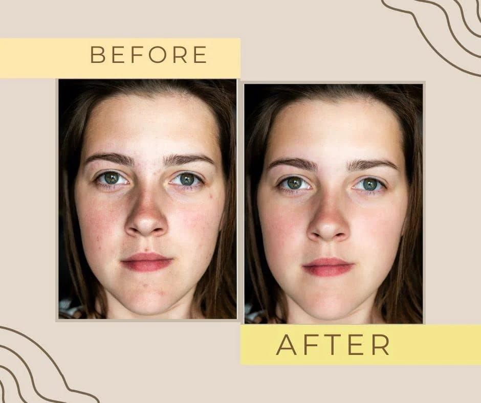 Zafrani Skin Brightening Cream – Natural Saffron Glow Formula